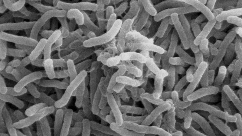 Scanning electron micrograph (SEM) showing numerous cholera bacteria with a scale bar visible at the bottom left.