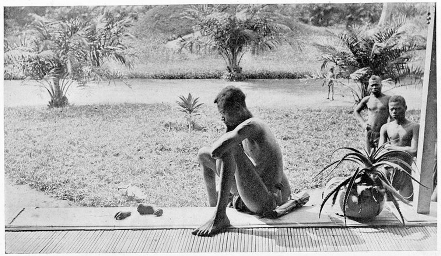Photo of a Congolese man, Nsala of Wala, looking at the hand and foot of his daughter, severed by agents of King Leopold. 
