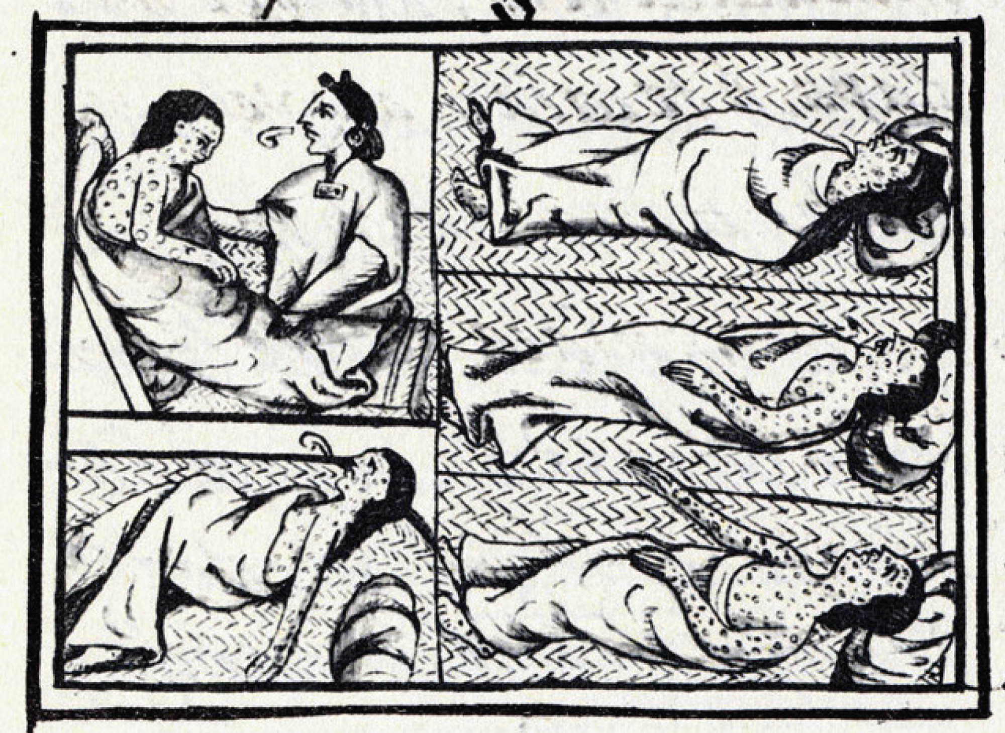 Drawing of a woman who is suffering from smallpox. Her body is covered in sores.