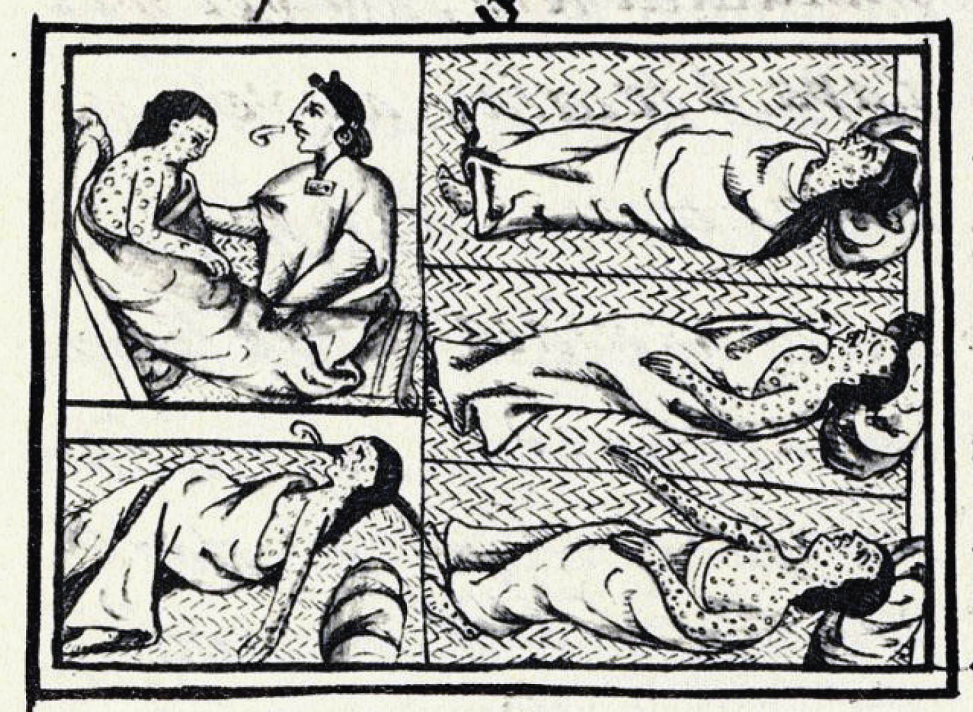 Drawing of a woman who is suffering from smallpox. Her body is covered in sores.