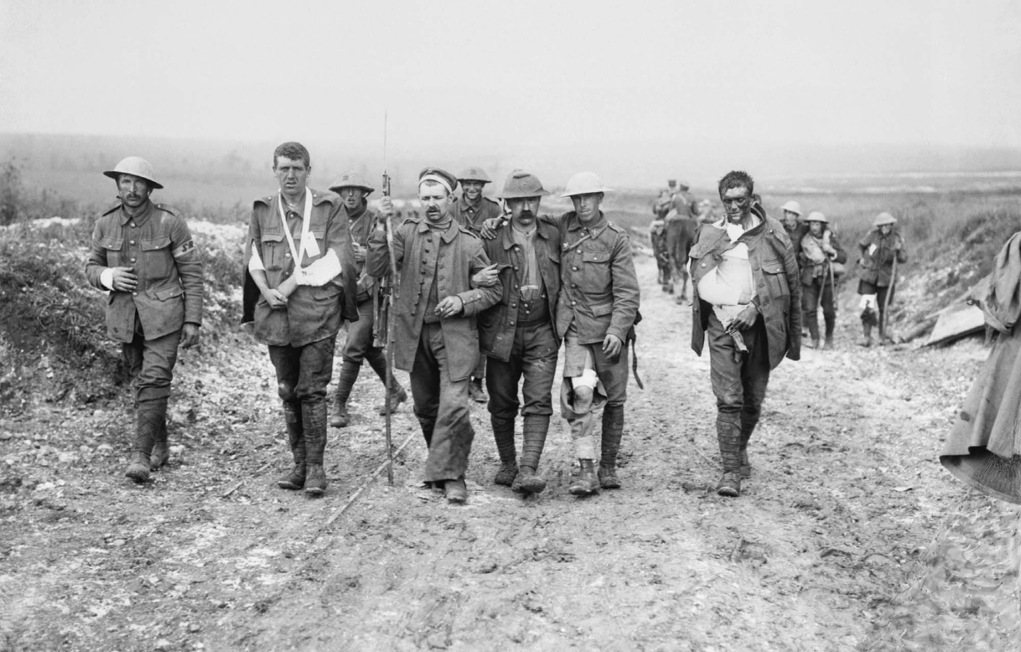Photo of wounded soldiers walking down a dirt road. A few of the more seriously injured are shown leaning on the other men to help them walk.     